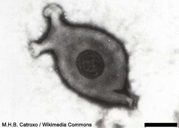 Coloration négative d'une bactérie Mycoplasma gallisepticum